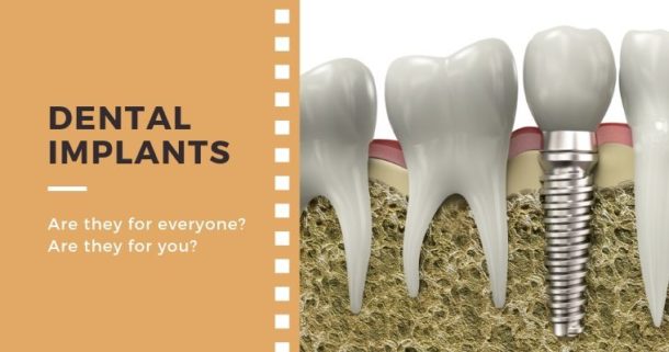 Dental Implants. Are they for everyone? Are they for you?